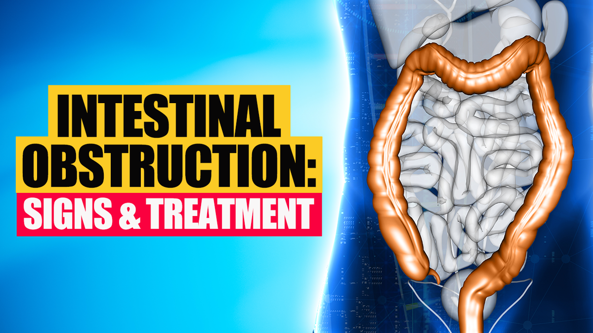 Intestinal Obstruction: Symptoms, Causes, Diagnosis & Treatment