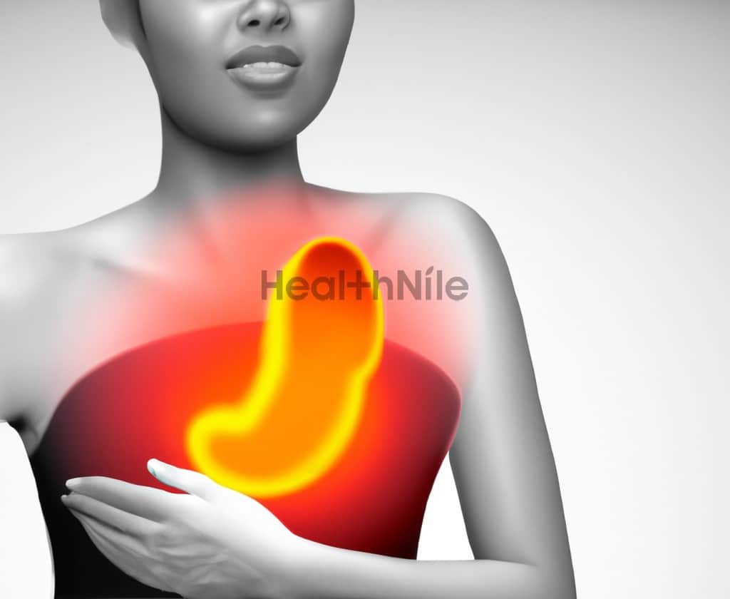 How to Get Rid of Acid Reflux